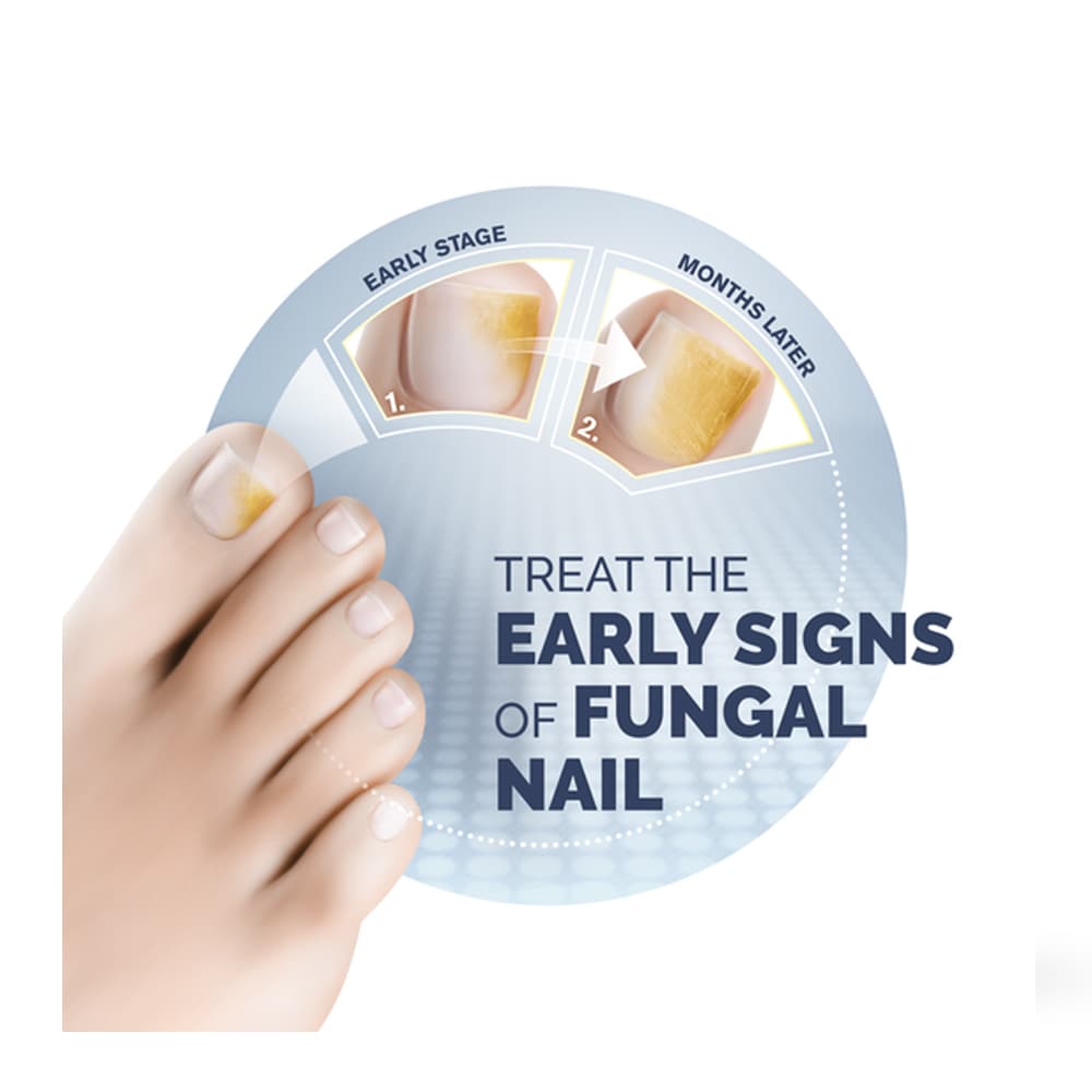 Produktbild 5 - Scholl Nagelsvampbehandling